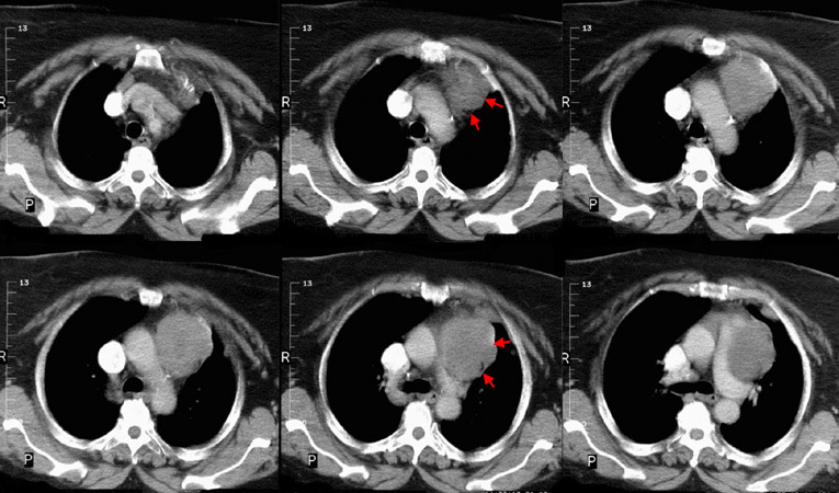 chest-radiology